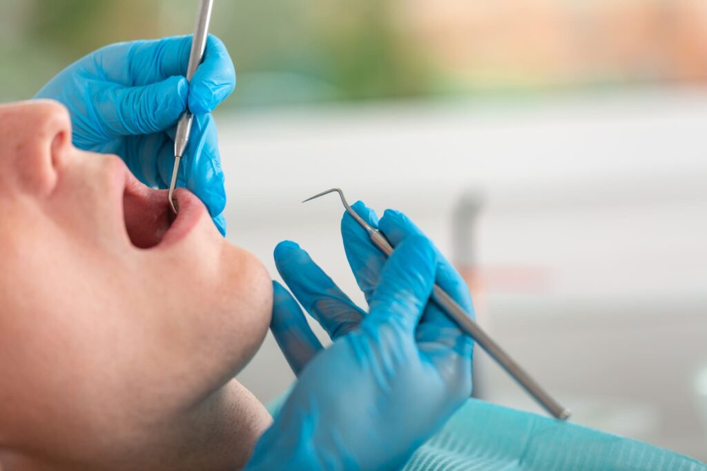 Pulizia dei denti e prevenzione della parodontite