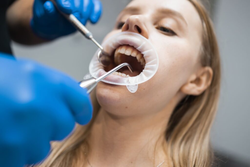 Pulizia dei denti e prevenzione della parodontite
